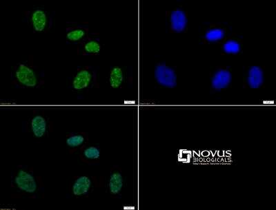 Immunocytochemistry/ Immunofluorescence: Histone H3 [p Thr11, p Ser10] Antibody - BSA Free [NB21-1092]